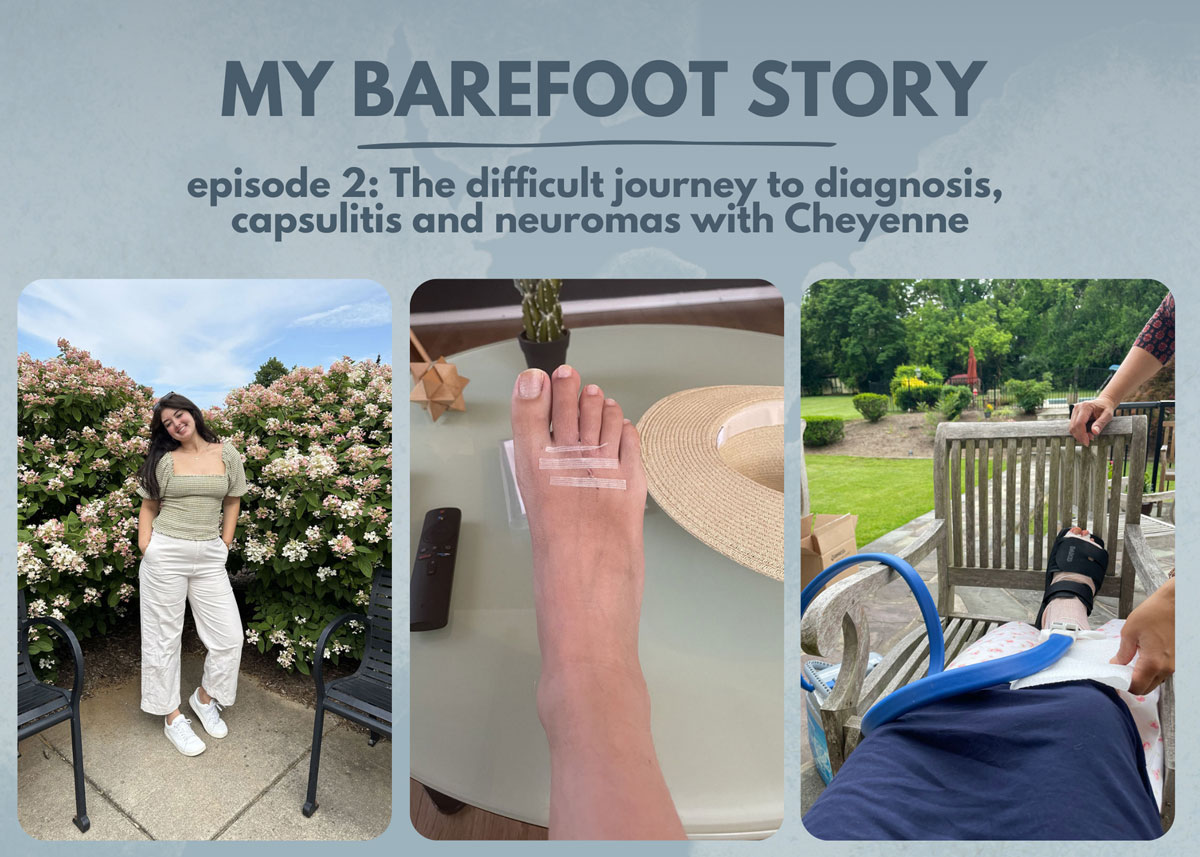 Are Barefoot Shoes Good for Capsulitis